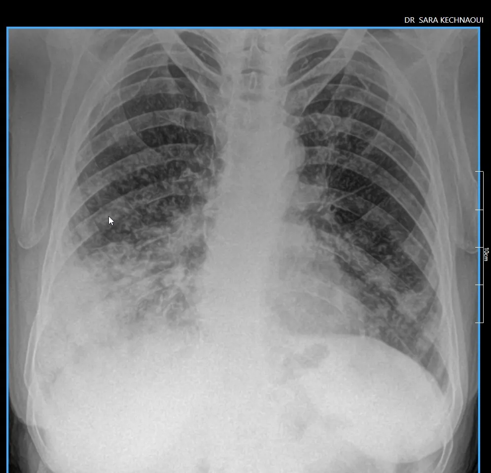 cabinet du dr Sara Kechnaoui - Infections respiratoires à Béni Mellal